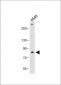 FBXL19 Antibody (C-term)